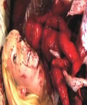 慢性折磨呕吐室